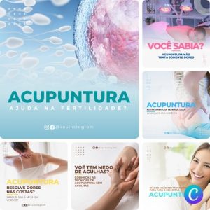 Imagem do Produto Pack de Posts Prontos para Acupuntura com Artes Editáveis no Canva