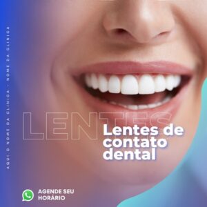 Artes para Consultório Odontológico Editáveis no Canva _ Posts Prontos com Títulos e Legendas para Facebook e Instagram