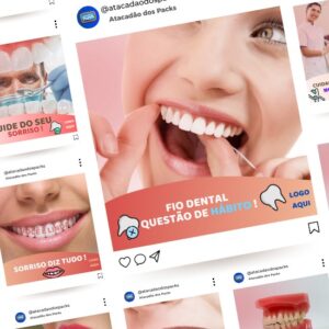 Artes para Dentistas Editáveis no Canva Pack com 50 Posts Prontos + Legendas para Facebook e Instagram