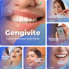 Posts para Dentistas 04 - Pack Canva com 10 Artes