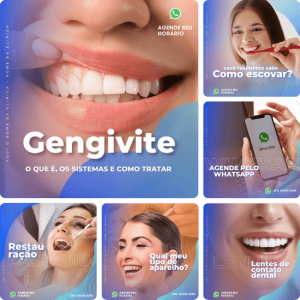 Posts para Dentistas 04 - Pack Canva com 10 Artes