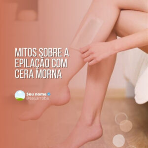 Imagem do Produto Posts para Depilação a Laser Editáveis no Canva com Títulos e Legendas
