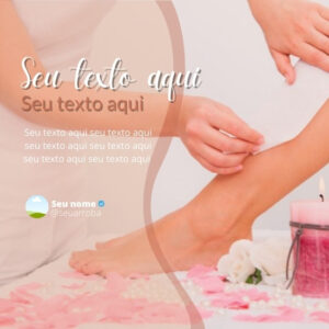 Imagem do Produto Posts para Depilação a Laser Editáveis no Canva com Títulos e Legendas
