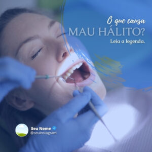 Artes para Redes Sociais de Dentistas _ 10 Templates Editáveis no Canva + Legendas Profissionais