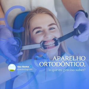 Artes para Redes Sociais de Dentistas _ 10 Templates Editáveis no Canva + Legendas Profissionais