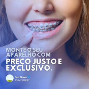 Posts e Templates Prontos para Dentistas _ Pack Canva Editável com Artes + Legendas para Instagram e Facebook