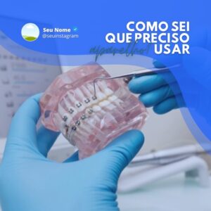 Posts e Templates Prontos para Dentistas _ Pack Canva Editável com Artes + Legendas para Instagram e Facebook
