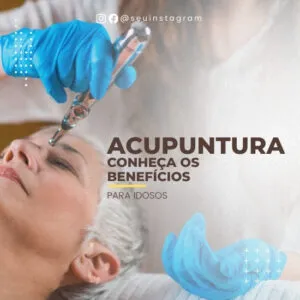 Imagem do Produto Pack de Posts Prontos para Acupuntura com Artes Editáveis no Canva