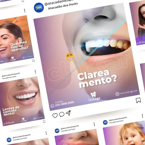 Artes para Clínica Odontológica Editáveis no Canva _ Posts Prontos com Títulos e Legendas para Facebook e Instagram