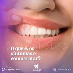 Artes para Clínica Odontológica Editáveis no Canva _ Posts Prontos com Títulos e Legendas para Facebook e Instagram