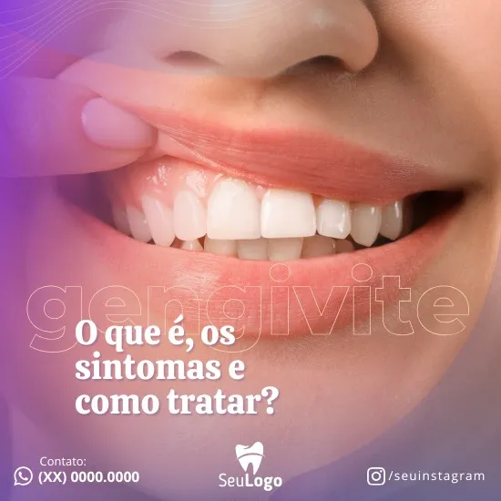 Artes para Clínica Odontológica Editáveis no Canva _ Posts Prontos com Títulos e Legendas para Facebook e Instagram