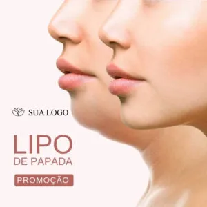 Imagem do Produto Posts Prontos para Clínica de Estética Facial e Corporal Editáveis no Canva com Títulos e Legendas