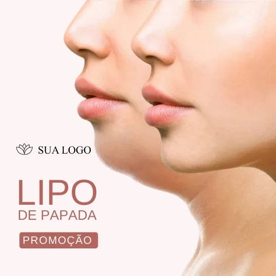 Imagem do Produto Posts Prontos para Clínica de Estética Facial e Corporal Editáveis no Canva com Títulos e Legendas