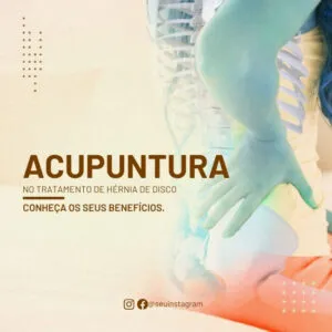 Imagem do Produto Pack de Posts Prontos para Acupuntura com Artes Editáveis no Canva