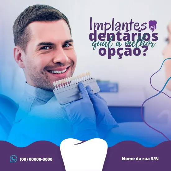 Pack de Posts e Templates para Dentistas _ Artes Editáveis no Canva + Textos e Legendas Inclusos