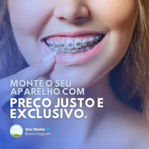 Posts e Templates Prontos para Dentistas _ Pack Canva Editável com Artes + Legendas para Instagram e Facebook